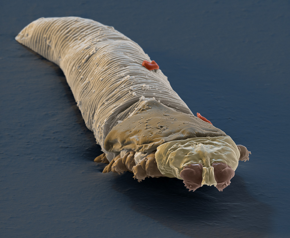 Colorized scanning electron micrograph of Demodex (Demodex folliculorum), tiny parasitic mites that live in the hair follicles of mammals. Their length ranges from .09-.5mm. Magnification: x1500 at 12x12 cm.